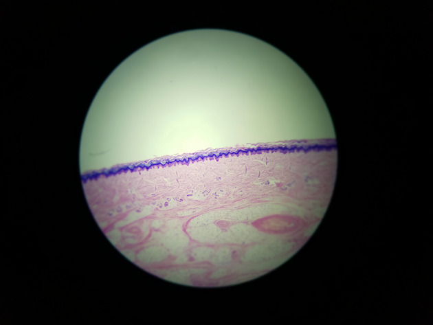 Stratified Squamous Epithelium Slides - Stratified Squamous Epithelium 05 40X
